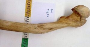 En la foto, el primer fémur del que se tenga la idea que haya sido curado