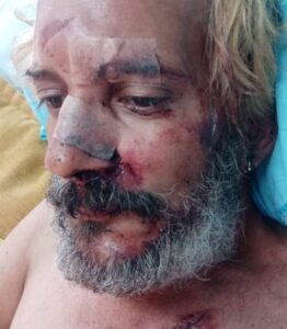 En la foto, Eduardo Longa, golpeado para robarle la moto y el celular