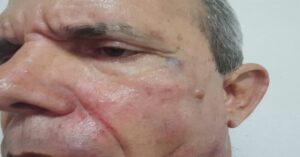 En la foto, imágenes de los golpes que recibió Jorge Fernández Era