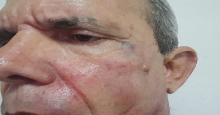 En la foto, imágenes de los golpes que recibió Jorge Fernández Era