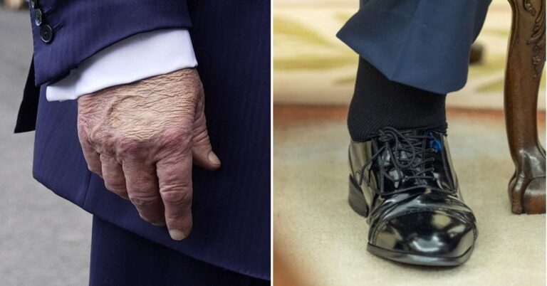 En la foto, un montaje con una mano y un pie de Trump