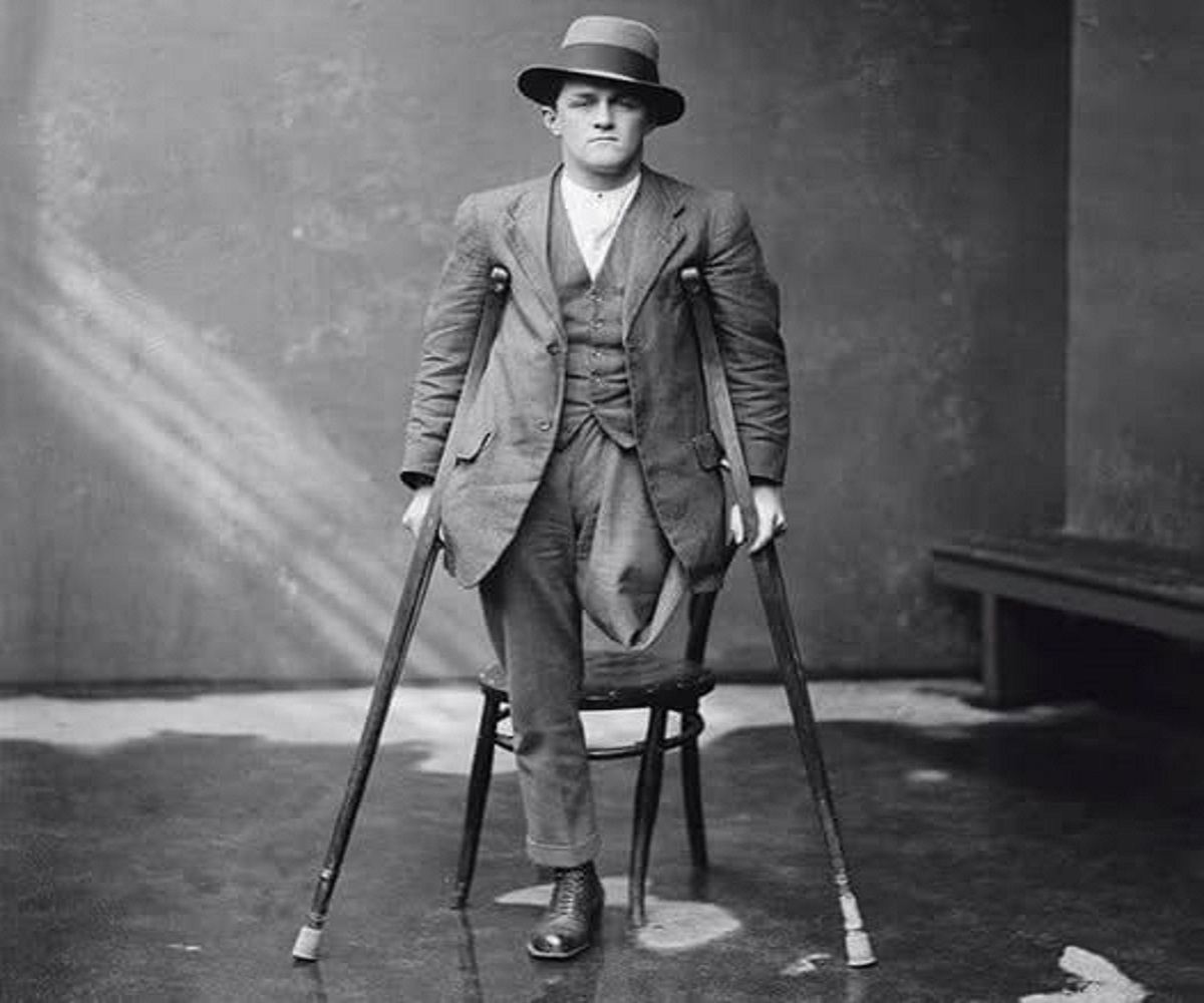 En la foto, un hombre con una pierta amputada