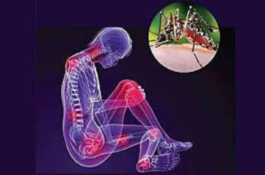 Voy para nueve días... con el virus