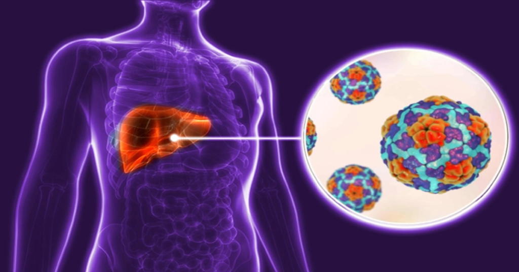 Brote de hepatitis en Ciego de Ávila
