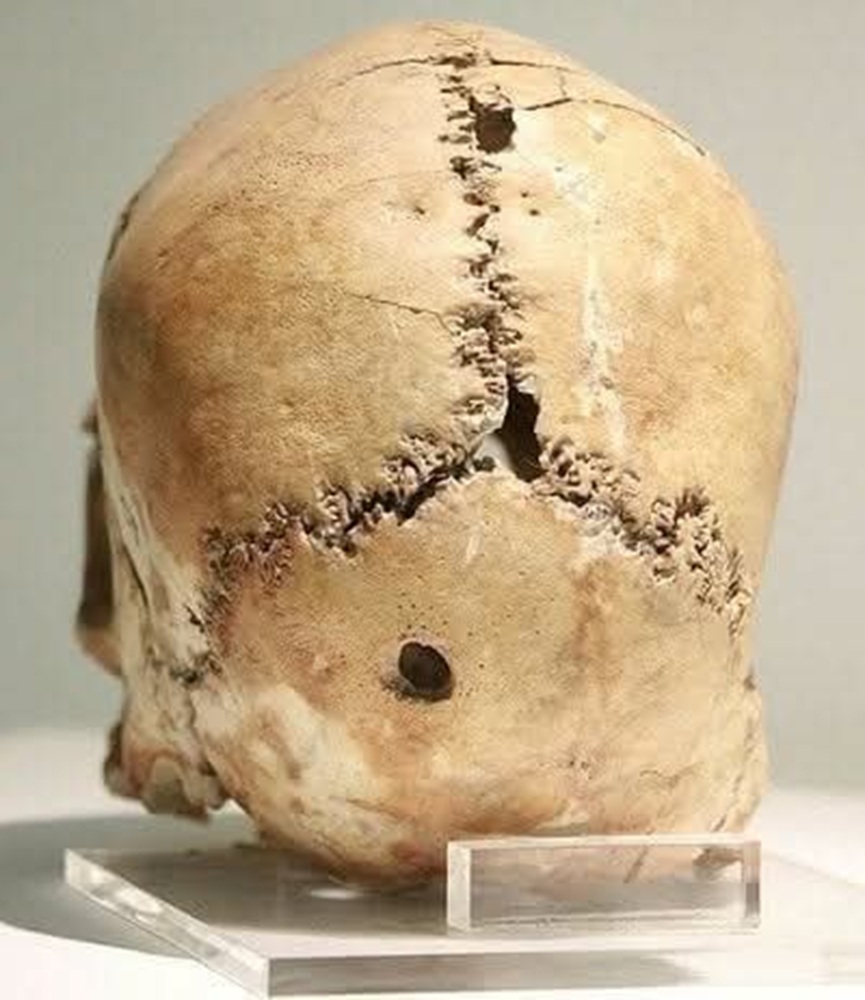 En la foto, el cráneo de referencia