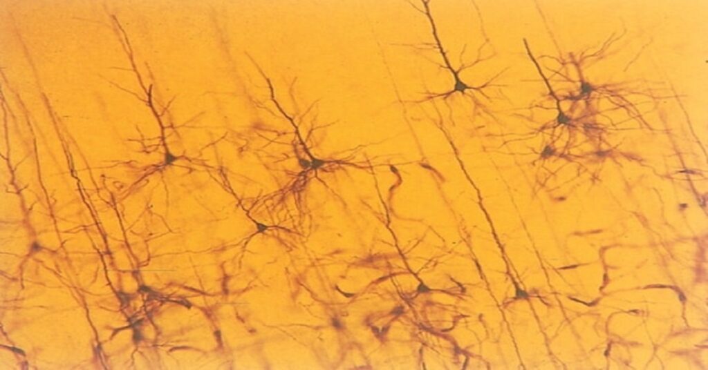 La reacción negra: el accidente que desveló el cerebro