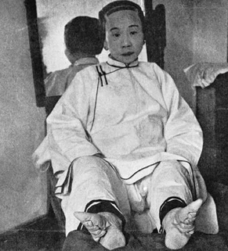 La elegancia impuesta: los pies rotos y el peso de la tradición 6 En la foto, una mujer china con pie de loto