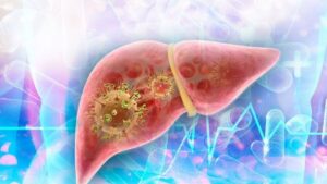 En la foto, hepatitis