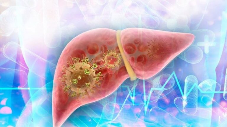 En la foto, hepatitis