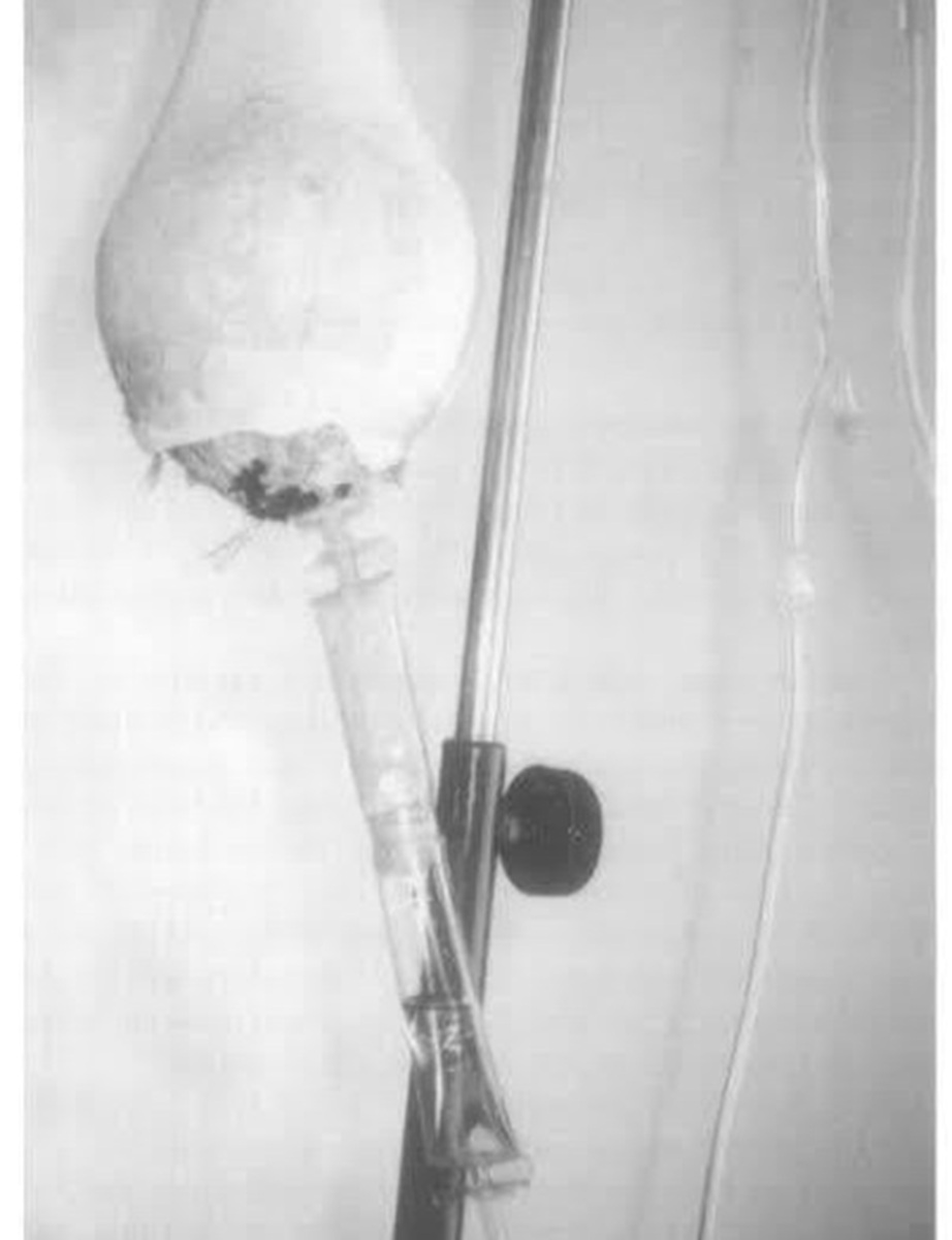 En la foto, un suero hecho con coco