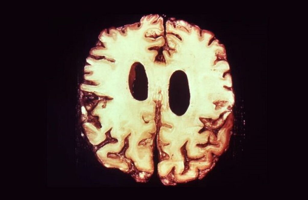 En la foto, una imagen relativa al texto