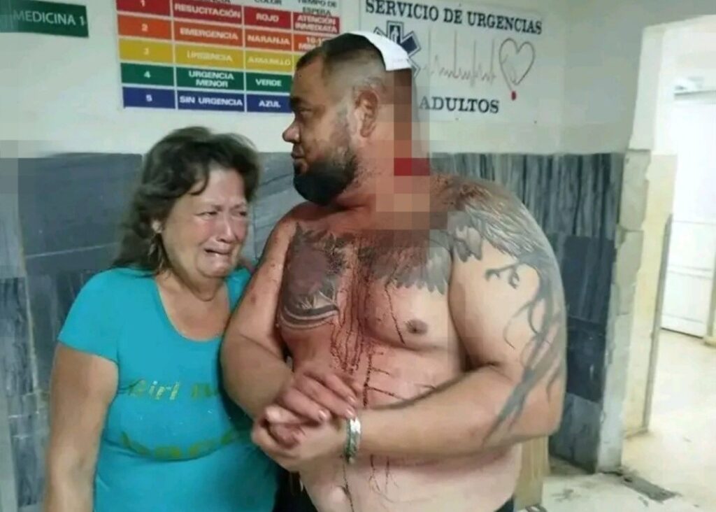 La historia detrás de la foto (LXXVIII) 3 En la foto, un hombre golpeado por la policía cubana, sangra
