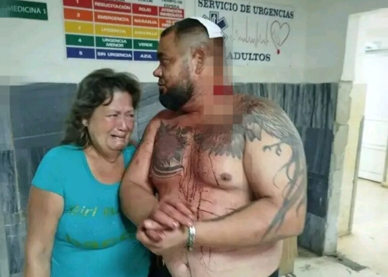 En la foto, un hombre golpeado por la policía cubana, sangra