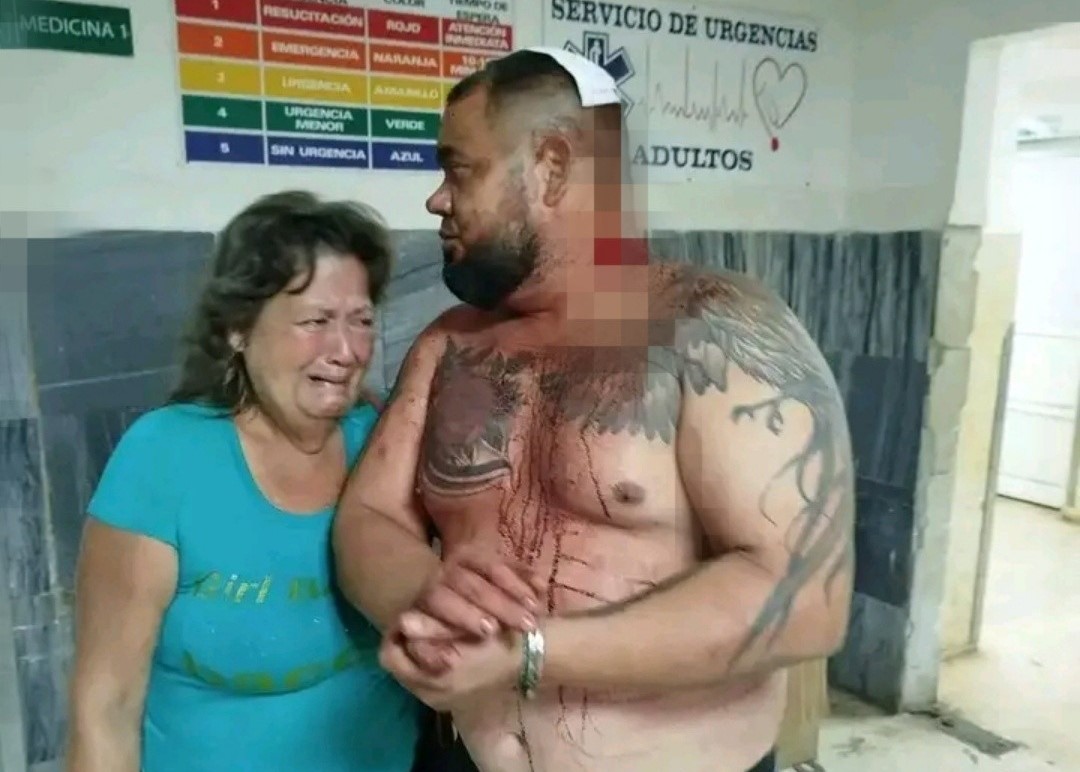 En la foto, un hombre golpeado por la policía cubana, sangra