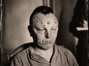 En la foto, un hombre mutilado, con heridas en e rostro