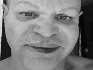 En la foto, el rostro de Raciel tras ser golpeado