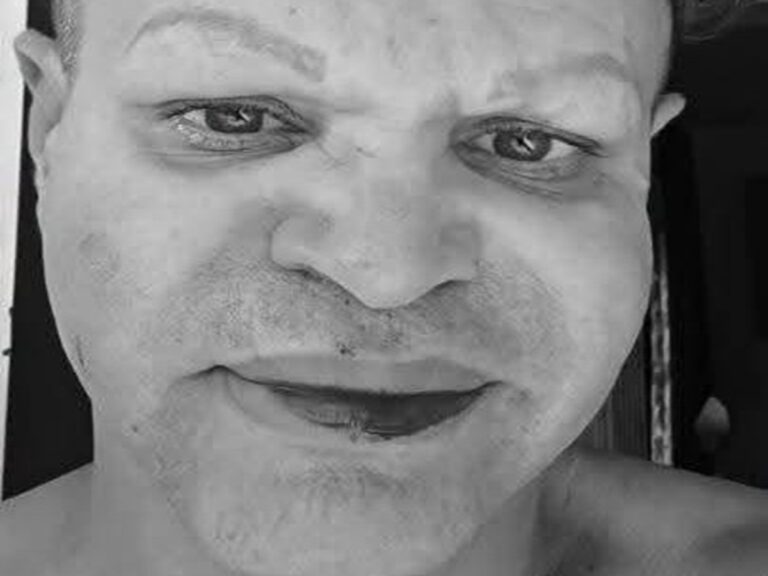 En la foto, el rostro de Raciel tras ser golpeado