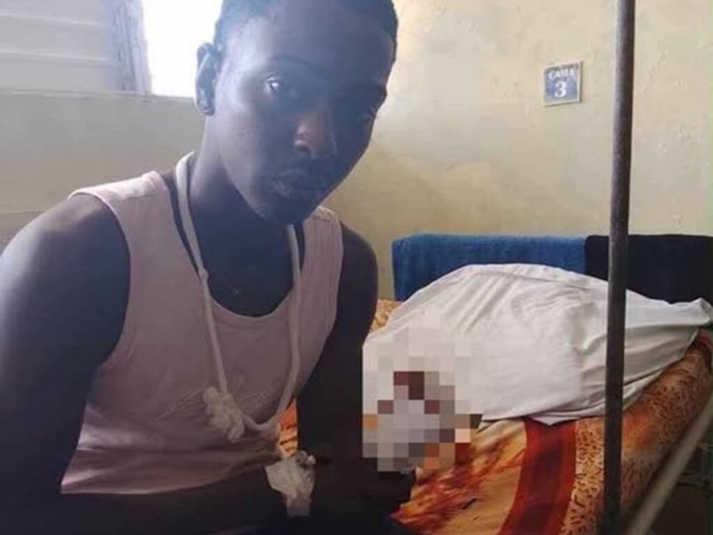 La justicia del machete: cuando el pueblo toma la ley por su mano 2 En la foto, el joven de Colón al que le cortaron una mano mientras robaba aguacates