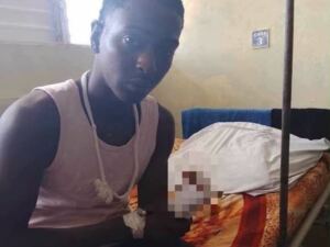 En la foto, el joven de Colón al que le cortaron una mano mientras robaba aguacates