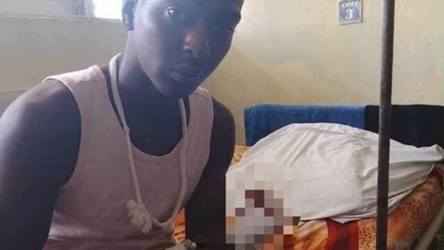 En la foto, el joven de Colón al que le cortaron una mano mientras robaba aguacates