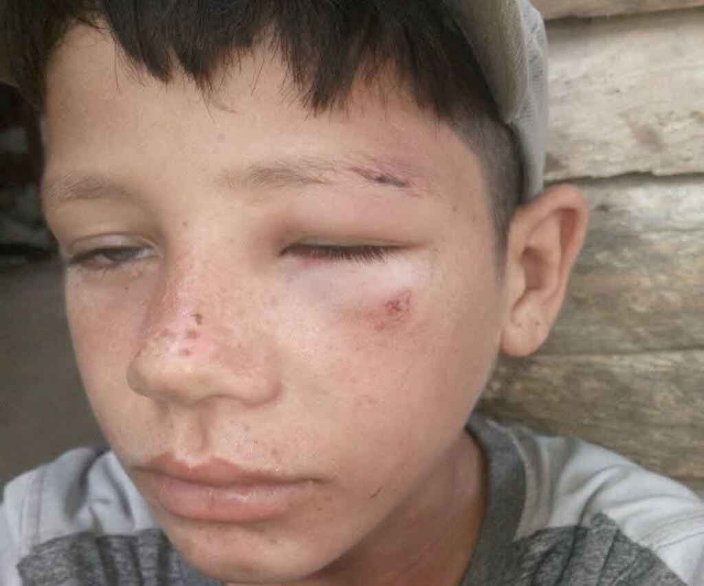 En la foto, el niño agredido por un colaborador de la Policía en Las Tunas