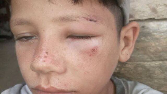 En la foto, el niño agredido por un colaborador de la Policía en Las Tunas