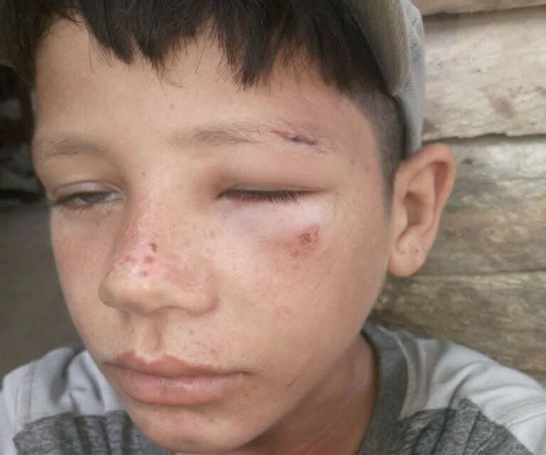 El precio de la violencia en Cuba: 55 pesos por un niño golpeado 1 En la foto, el niño agredido por un colaborador de la Policía en Las Tunas