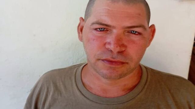 Osmany Hernández y la historia del régmen que abandona a los suyos 1 En la foto, Osmany Hernández, el liniero que perdió los brazos