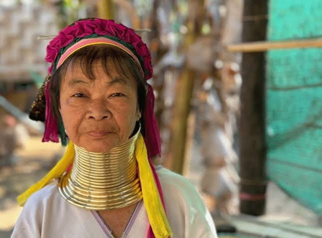 De tablillas y corsés: la épica (y dolorosa) historia de presumir 3 En la foto, una mujer jirafa