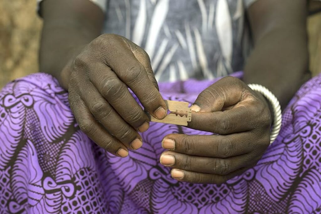 La infibulación: una cicatriz de la Humanidad 2 En la foto, una mujer africana con una de las cuchillas que usan para mutilar a las niñas