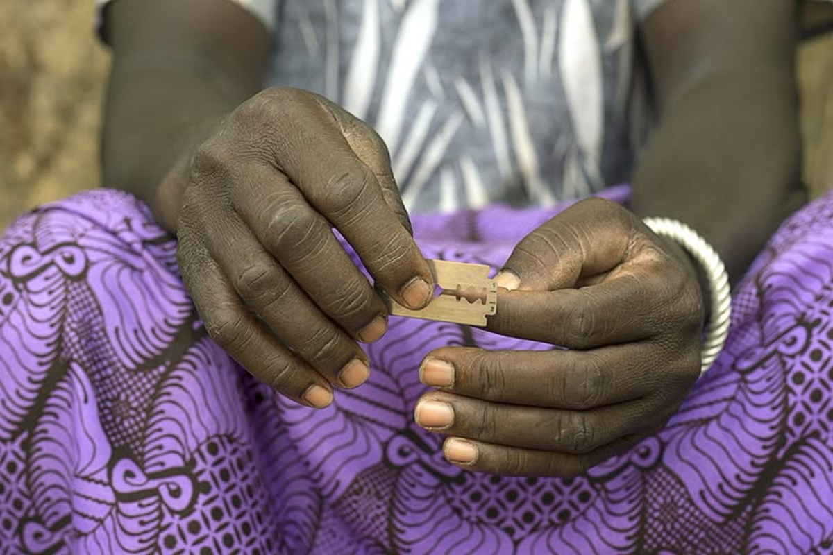 La infibulación: una cicatriz de la Humanidad 1 En la foto, una mujer africana con una de las cuchillas que usan para mutilar a las niñas