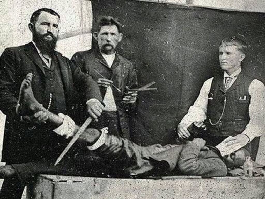 En la foto, un quirófano en el siglo XIV
