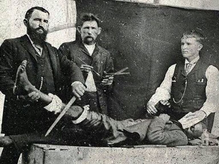 En la foto, un quirófano en el siglo XIV