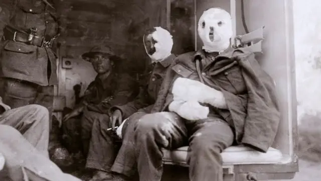 La guerra que salió en la red 1 En la foto, los pescadores afectados por el gas mostaza