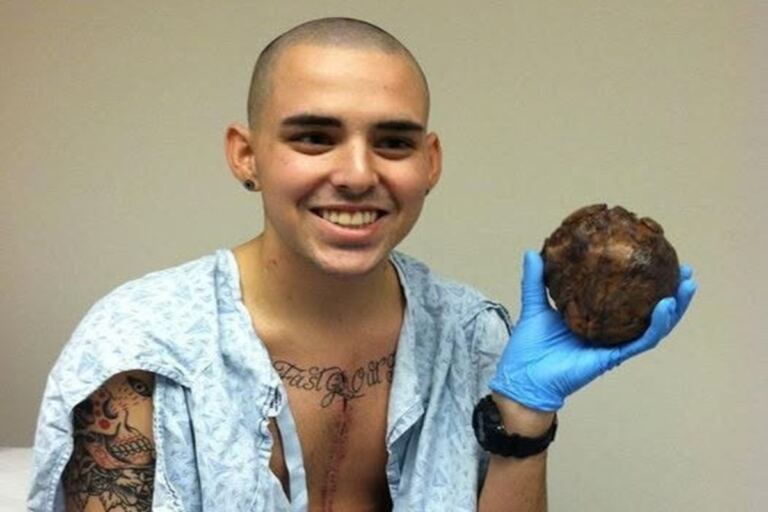 En la foto, Brandon Linkenhoker con su corazón en la mano